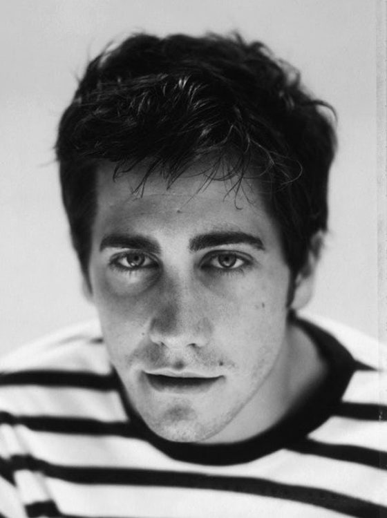 Jake Gyllenhaal Juvenile Hairline