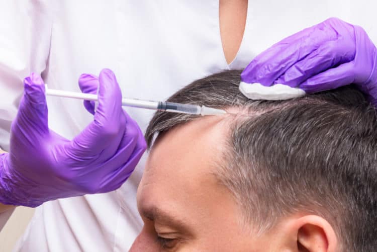 PRP injection for hair growth