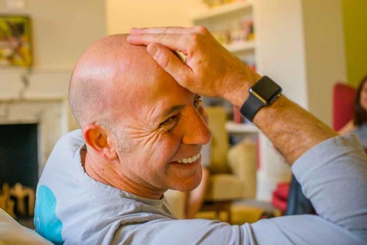 Shiny bald head from head waxing.