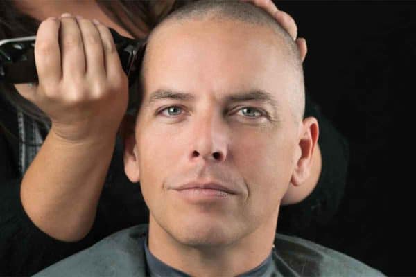 Bald Head Care Tips