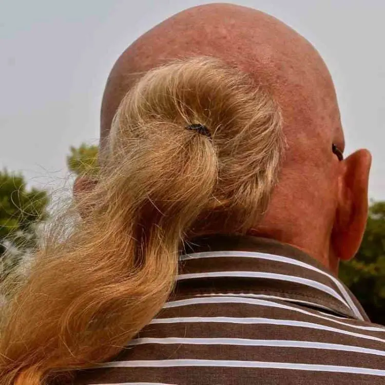 Bald Ponytail is a bad look