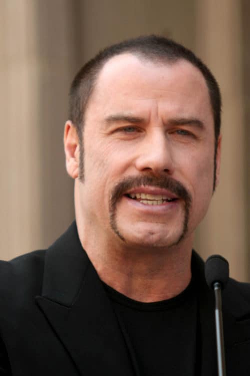 John Travolta's bad receding hairline