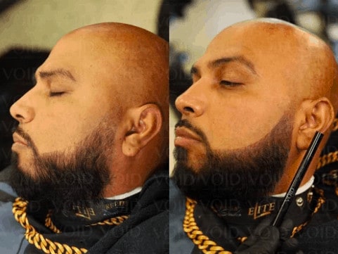 Before After Beard Filler