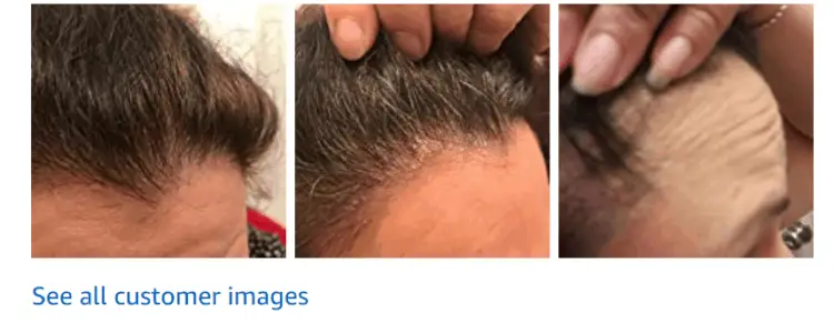 Before and After Briogeo Scalp Revival