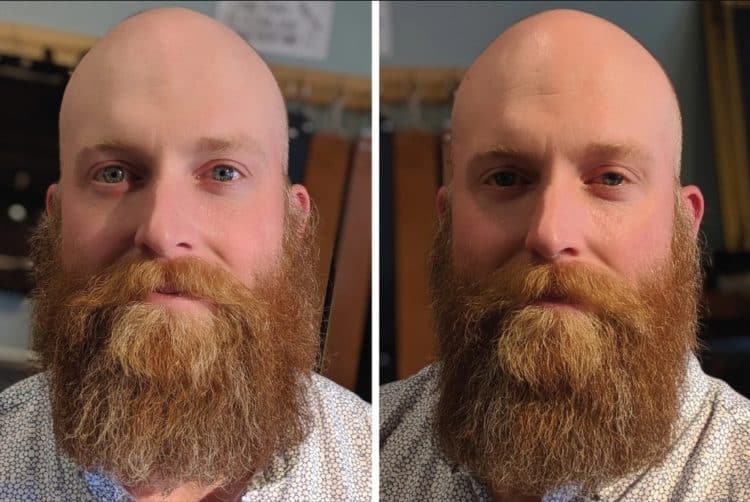 Before After Straightened Beard 750x502 