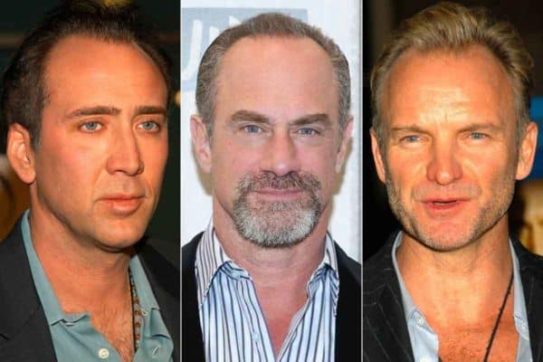 14 Male Celebrities with Receding Hairlines - Bald & Beards