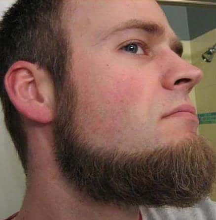 Chin strap beard with no mustache