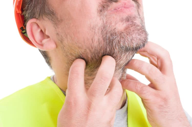 Beard Itch is a common problem especially for new beard growth.