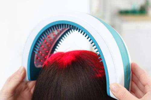 Does Laser Hair Therapy Work