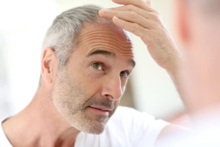 Rogaine may cause side effects like Dry Scalp