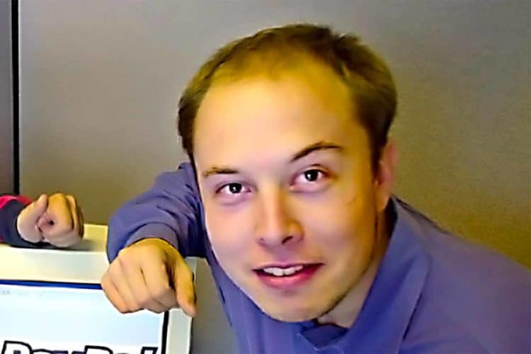 Elon Musk balding.