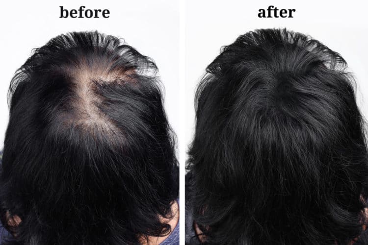 Toppik before and after - Hair fibers for women.