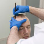 How Long Does Scalp Micropigmentation Last