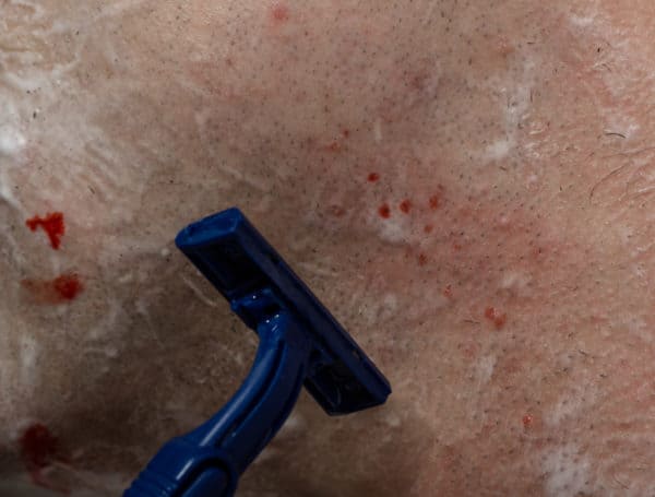 Stop a shaving cut from bleeding by improving your shave technique.
