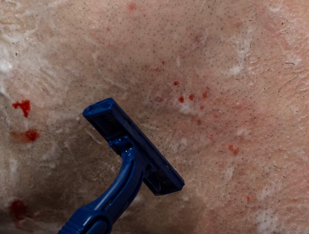 accidentally cut a mole while shaving