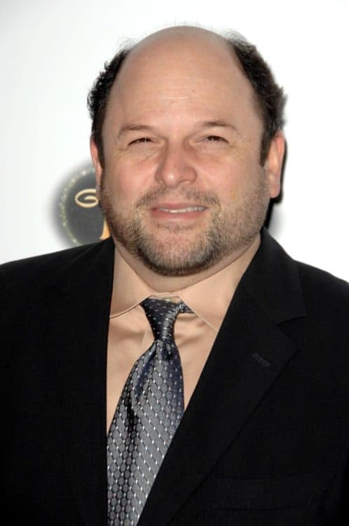 Jason Alexander with a horseshoe shaped hairline.