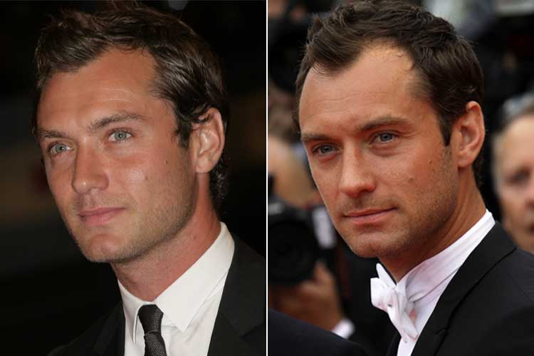 Jude Law's hair loss shows most in his hairline
