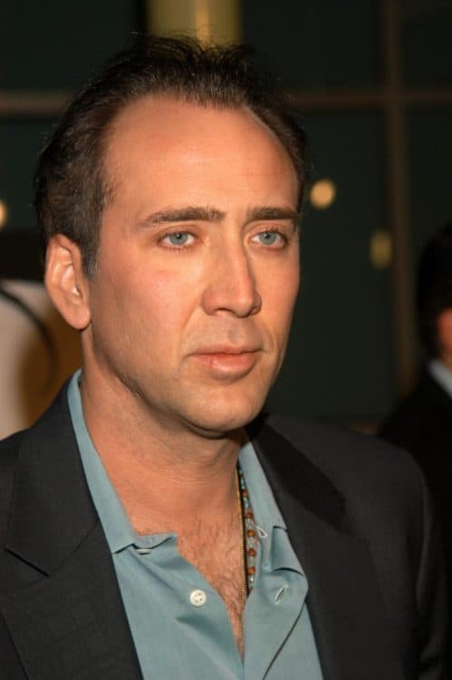 Nicolas Cage Hairline has receded