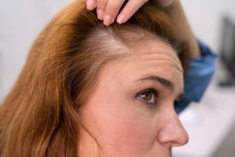 scalp micropigmentation for long hair