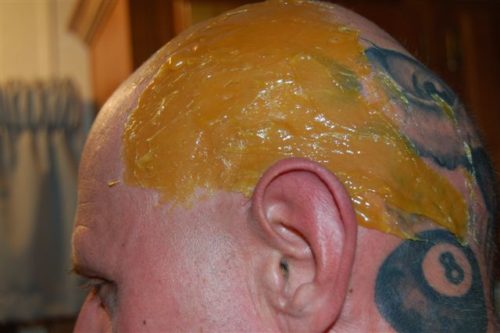 Sugaring paste treatment for a bald head look.