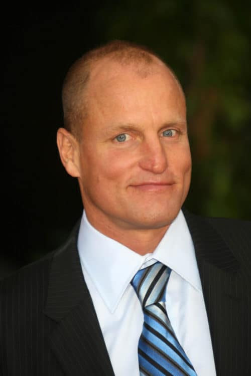 Woody Harrelson Balding